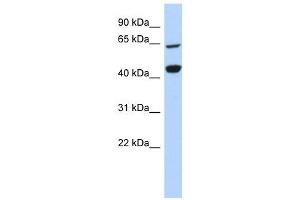 RFC4 antibody used at 1 ug/ml to detect target protein. (RFC4 Antikörper)