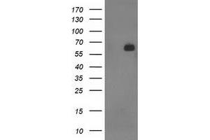 HEK293T cells were transfected with the pCMV6-ENTRY control (Left lane) or pCMV6-ENTRY SH2B3 (Right lane) cDNA for 48 hrs and lysed. (SH2B3 Antikörper)