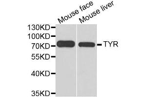 Western blot analysis of extracts of various cell lines, using TYR antibody. (TYR Antikörper  (AA 20-340))