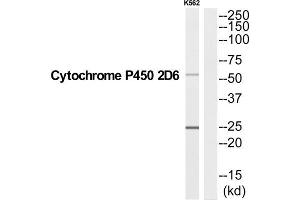 Western Blotting (WB) image for anti-Cytochrome P450, Family 2, Subfamily D, Polypeptide 6 (CYP2D6) (C-Term) antibody (ABIN1852641) (CYP2D6 Antikörper  (C-Term))