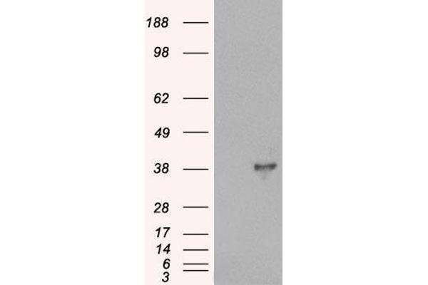 DOK5 Antikörper  (C-Term)