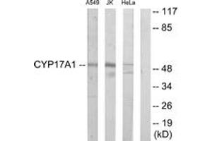 Western Blotting (WB) image for anti-Cytochrome P450, Family 17, Subfamily A, Polypeptide 1 (CYP17A1) (AA 221-270) antibody (ABIN2889934) (CYP17A1 Antikörper  (AA 221-270))