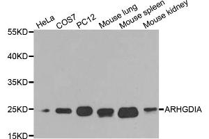 Western blot analysis of extracts of various cell lines, using ARHGDIA antibody (ABIN5970556) at 1/1000 dilution. (ARHGDIA Antikörper)