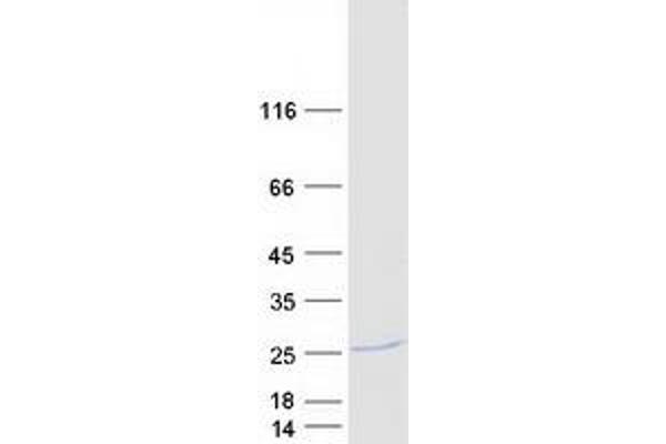 NDUFAF4 Protein (Myc-DYKDDDDK Tag)