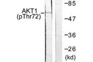 Western blot analysis of extracts from NIH-3T3 cells treated with TNF-a 20ng/ml 30', using Akt (Phospho-Thr72) Antibody. (AKT1 Antikörper  (pThr72))
