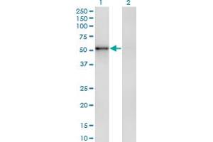 Western Blot analysis of ZNF207 expression in transfected 293T cell line by ZNF207 monoclonal antibody (M04), clone 8G7. (ZNF207 Antikörper  (AA 1-110))