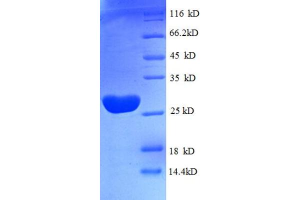 TUFM Protein (AA 46-290, partial) (His tag)