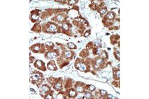 Image no. 2 for anti-Salt-Inducible Kinase 1 (SIK1) (C-Term) antibody (ABIN360572) (SIK1 Antikörper  (C-Term))