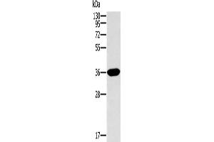 Gel: 10 % SDS-PAGE, Lysate: 40 μg, Lane: Human fetal intestine tissue, Primary antibody: ABIN7129939(ITLN1 Antibody) at dilution 1/400, Secondary antibody: Goat anti rabbit IgG at 1/8000 dilution, Exposure time: 2 minutes (ITLN1/Omentin Antikörper)