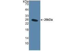 Detection of Recombinant CD40L, Human using Polyclonal Antibody to Cluster Of Differentiation 40 Ligand (CD40L) (CD40 Ligand Antikörper  (AA 48-244))