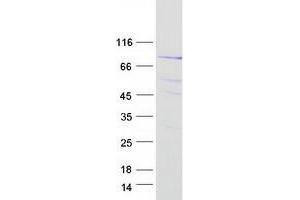 Validation with Western Blot (SGSM3 Protein (Myc-DYKDDDDK Tag))