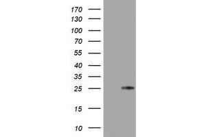 HEK293T cells were transfected with the pCMV6-ENTRY control (Left lane) or pCMV6-ENTRY TIMP2 (Right lane) cDNA for 48 hrs and lysed. (TIMP2 Antikörper)