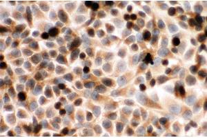 Anti-Cytochrome P450 Reductase antibody, ICC ICC: HELA Cell (POR Antikörper  (C-Term))