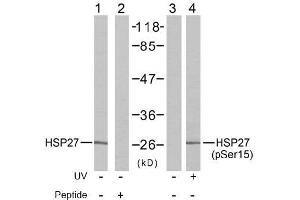 Image no. 2 for anti-Heat Shock 27kDa Protein 1 (HSPB1) (pSer15) antibody (ABIN196895) (HSP27 Antikörper  (pSer15))