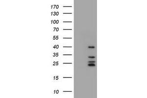 Image no. 2 for anti-Membrane-Spanning 4-Domains, Subfamily A, Member 1 (MS4A1) antibody (ABIN1497205) (CD20 Antikörper)