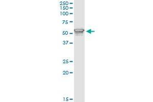 Immunoprecipitation (IP) image for anti-Phosphoinositide 3 Kinase, p85 alpha (PI3K p85a) (AA 1-454) antibody (ABIN518903)