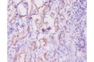 Immunohistochemistry of paraffin-embedded human kidney tissue using  at dilution of 1:20 (Inhibin alpha Antikörper  (AA 233-366))