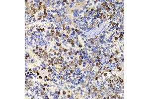 Immunohistochemistry of paraffin-embedded rat spleen using UBASH3B antibody. (UBASH3B Antikörper)