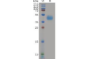 Human Protein, hFc Tag on SDS-PAGE under reducing condition. (CCR7 Protein (AA 25-59) (Fc Tag))