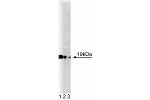 Western blot analysis of Cofilin on mouse cerebrum lysate. (Cofilin Antikörper  (AA 3-98))