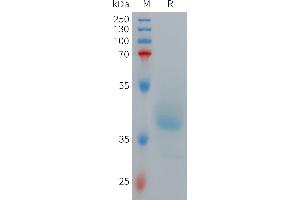 Human GRPR Protein, hFc Tag on SDS-PAGE under reducing condition. (GRPR Protein (AA 1-38) (Fc Tag))
