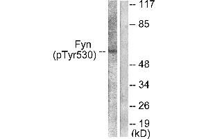 Western blot analysis of extracts from 293 cells, treated with H2O2 (100uM, 15mins), using Fyn (Phospho-Tyr530) antibody (#A0430). (FYN Antikörper  (pTyr530))
