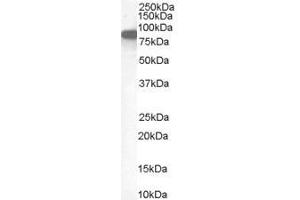 Western Blotting (WB) image for anti-Ezrin (EZR) antibody (ABIN5886568) (Ezrin Antikörper)