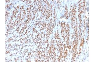 Formalin-fixed, paraffin-embedded human Colon stained with Retinoblastoma (Rb1) Monoclonal Antibody (1F8). (Retinoblastoma 1 Antikörper)