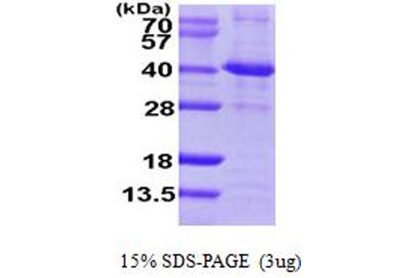 SIRT2 Protein (AA 1-352) (His tag)