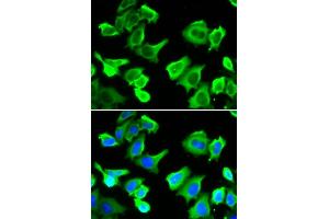 Immunofluorescence analysis of  cells using HSP27/HSP27/HSPB1 antibody (ABIN6128036, ABIN6142051, ABIN6142053 and ABIN6217766). (HSP27 Antikörper  (AA 1-100))