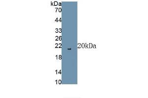 Detection of Recombinant FGF2, Rat using Polyclonal Antibody to Fibroblast Growth Factor 2, Basic (FGF2) (FGF2 Antikörper)