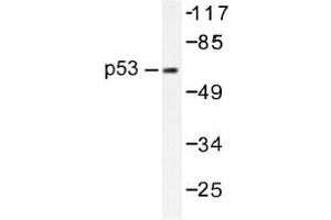 Image no. 1 for anti-Tumor Protein P53 (TP53) antibody (ABIN317853) (p53 Antikörper)