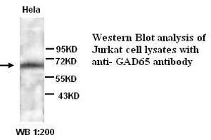 Image no. 1 for anti-Glutamate Decarboxylase 2 (Pancreatic Islets and Brain, 65kDa) (GAD2) antibody (ABIN790972) (GAD65 Antikörper)