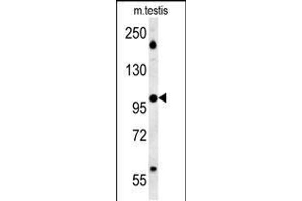 WDR11 Antikörper  (AA 544-572)