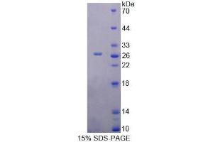 SDS-PAGE analysis of Rat YAF2 Protein. (YAF2 Protein)