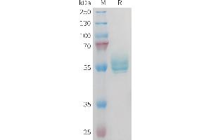 Mouse TN Protein, hFc Tag on SDS-PAGE under reducing condition. (TNFSF15 Protein (Fc Tag))