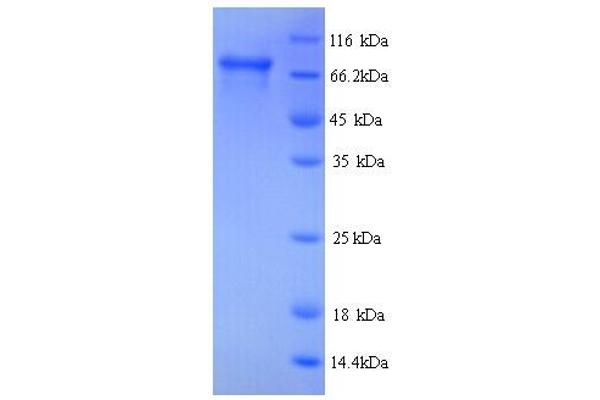 HSD17B4 Protein (AA 1-736, full length) (His tag)