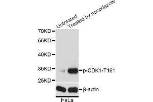 Western blot analysis of extracts of HeLa cells, using Phospho-CDK1-T161 antibody (ABIN5969957) at 1/2000 dilution. (CDK1 Antikörper  (pThr161))