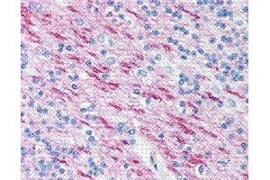 Immunohistochemistry (IHC) image for anti-Myelin Basic Protein (MBP) (AA 84-89) antibody (ABIN2475508) (MBP Antikörper  (AA 84-89))