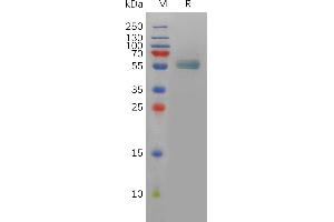 Ectodysplasin A Protein (EDA) (Fc Tag)