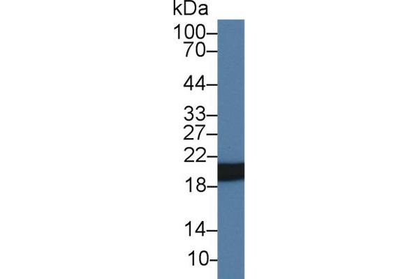 HSPB6 Antikörper  (AA 1-162)