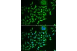 Immunofluorescence analysis of MCF-7 cells using SCG2 antibody. (SCG2 Antikörper)