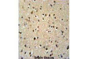 Immunohistochemistry (IHC) image for anti-threonine Synthase-Like 2 (THNSL2) antibody (ABIN3002296) (THNSL2 Antikörper)