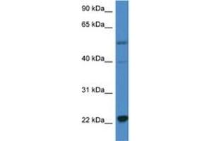Image no. 1 for anti-Interleukin 18 (IL18) (C-Term) antibody (ABIN6746899) (IL-18 Antikörper  (C-Term))