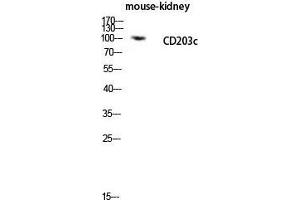 Western Blot (WB) analysis of Mouse Kidney lysis using CD203c antibody. (ENPP3 Antikörper  (Internal Region))