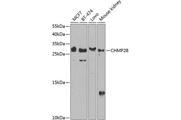 CHMP2B Antikörper  (AA 1-213)