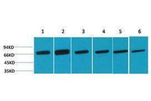 Western Blotting (WB) image for anti-Heat Shock 70kDa Protein 8 (HSPA8) antibody (ABIN3181509) (Hsc70 Antikörper)