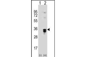 Western blot analysis of T1 (arrow) using rabbit polyclonal T1 Antibody  (ABIN389117 and ABIN2839303). (PPT1 Antikörper  (C-Term))