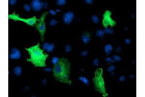 Immunofluorescence (IF) image for anti-Cerebral Cavernous Malformation 2 (CCM2) antibody (ABIN1497135) (CCM2 Antikörper)