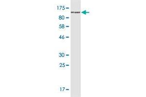 Western Blot detection against Immunogen (102. (CD44 Antikörper  (AA 1-699))